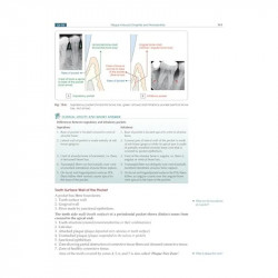 Textbook Of Periodontology For Undergraduate Students (Pb 2025) book by Devinder Singh Kalsi, Parul Kalsi - Additional Image 6