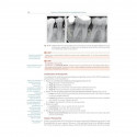 Textbook Of Periodontology For Undergraduate Students (Pb 2025) book by Devinder Singh Kalsi, Parul Kalsi - Additional Image 8