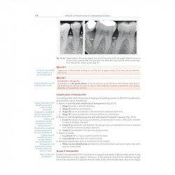Textbook Of Periodontology For Undergraduate Students (Pb 2025) book by Devinder Singh Kalsi, Parul Kalsi - Additional Image 8