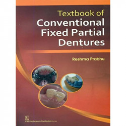 TEXTBOOK OF CONVENTIONAL FIXED PARTIAL DENTURES (PB 2014) book by PRABHU R.