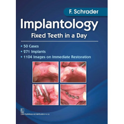 IMPLANTOLOGY FIXED TEETH IN A DAY (PB 2017) book by SCHRADER