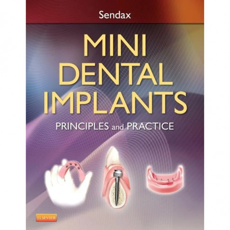 Mini Dental Implants: Principles and Practice book by Sendax