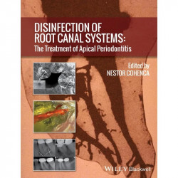 Disinfection of Root Canal Systems: The Treatment of Apical Periodontitis book by Nestor Cohenca