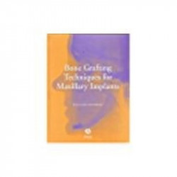 Bone Grafting Techniques For Maxillary Implants book by Karl Erik Kahnberg