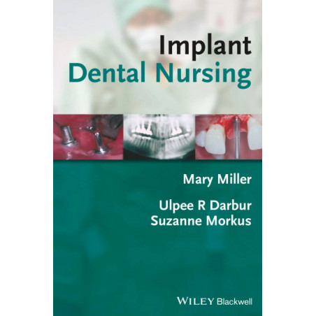 Implant Dental Nursing book by M Miller
