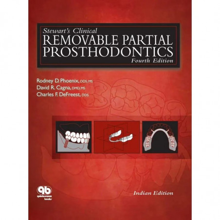 STEWARTS CLINICAL REMOVABLE PARTIAL PROSTHODONTICS 4ED (HB 2017) book by PHOENIX R.D.