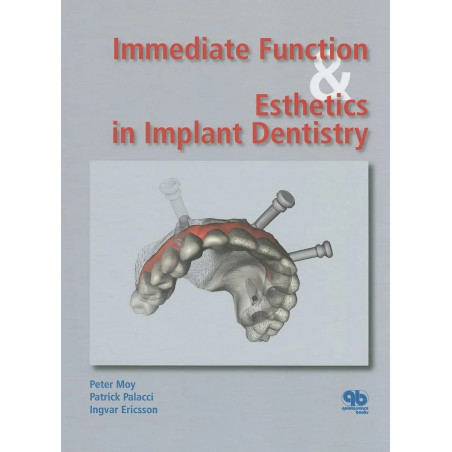 Immediate Function And Esthetics In Implant Dentistry (Hb 2008) book by MOY P.