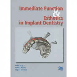 Immediate Function And Esthetics In Implant Dentistry (Hb 2008) book by MOY P. - Back Cover