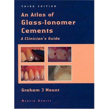AN ATLAS OF GLASS-IONOMER CEMENTS A CLINICIAN'S GUIDE book by Graham J. Mount