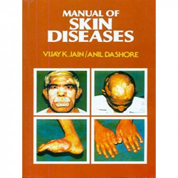 Manual Of Skin Diseases (Pb 2022) book by JAIN V. K