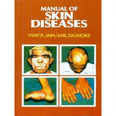 Manual Of Skin Diseases (Pb 2022) book by JAIN V. K