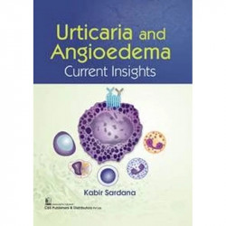 URTICARIA AND ANGIOEDEMA CURRENT INSIGHTS (PB 2022) book by KABIR SARDANA