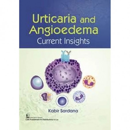 URTICARIA AND ANGIOEDEMA CURRENT INSIGHTS (PB 2022) book by KABIR SARDANA