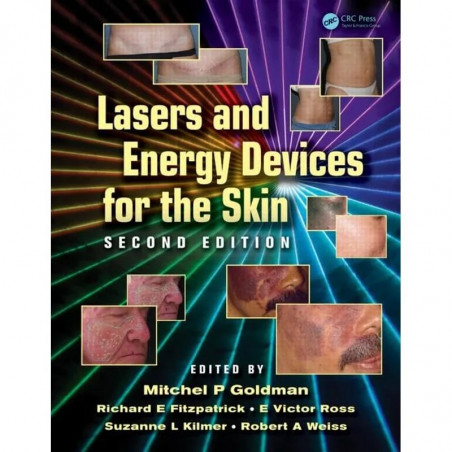 LASERS AND ENERGY DEVICES FOR THE SKIN 2ED (HB 2013) book by Mitchel P. Goldman, Richard E. Fitzpatrick