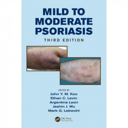 MILD TO MODERATE PSORIASIS 3ED book by John Koo, Ethan Levin