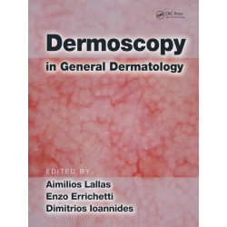 Dermoscopy in General Dermatology book by Aimilios Lallas, Enzo Errichetti