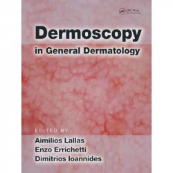 Dermoscopy in General Dermatology book by Aimilios Lallas, Enzo Errichetti - Back Cover