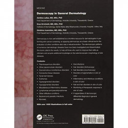 Dermoscopy in General Dermatology book by Aimilios Lallas, Enzo Errichetti - Additional Image 4