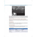 Practical Manual of Percutaneous Tracheostomy (HB 2026) book by Anil Kumar, Puneet Khanna - Additional Image 5