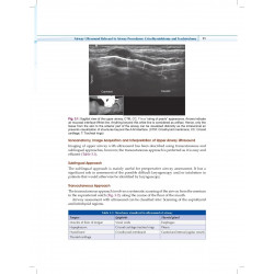 Practical Manual of Percutaneous Tracheostomy (HB 2026) book by Anil Kumar, Puneet Khanna - Additional Image 5
