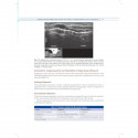 Practical Manual of Percutaneous Tracheostomy (HB 2026) book by Anil Kumar, Puneet Khanna - Additional Image 6