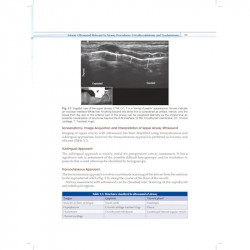 Practical Manual of Percutaneous Tracheostomy (HB 2026) book by Anil Kumar, Puneet Khanna - Additional Image 6
