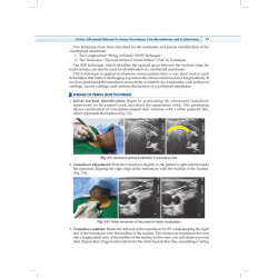 Practical Manual of Percutaneous Tracheostomy (HB 2026) book by Anil Kumar, Puneet Khanna - Additional Image 7