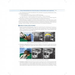 Practical Manual of Percutaneous Tracheostomy (HB 2026) book by Anil Kumar, Puneet Khanna - Additional Image 8