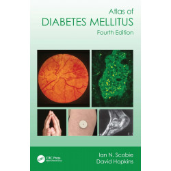 Atlas of Diabetes Mellitus book by Ian N. Scobie, David Hopkins