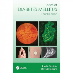 Atlas of Diabetes Mellitus book by Ian N. Scobie, David Hopkins - Back Cover