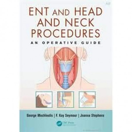 ENT and Head and Neck Procedures book by MOCHLOULIS