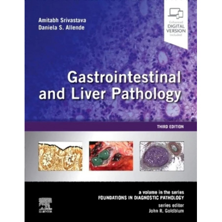 Gastrointestinal and Liver Pathology: A Volume in the Series: Foundations in Diagnostic Pathology book by M.D. Srivastava, A…