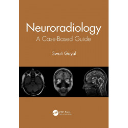 Neuroradiology A Case Based Guide (Pb 2021) book by Swati Goyal
