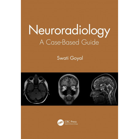 Neuroradiology A Case Based Guide (Pb 2021) book by Swati Goyal