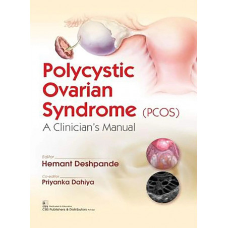 POLYCYSTIC OVARIAN SYNDROME (PCOS) A CLINICIANS MANUAL (PB 2019) book by HEMANTH DESHPANDE