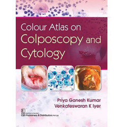 COLOUR ATLAS ON COLPOSCOPY AND CYTOLOGY (HB 2020) book by PRIYA GANESH KUMAR