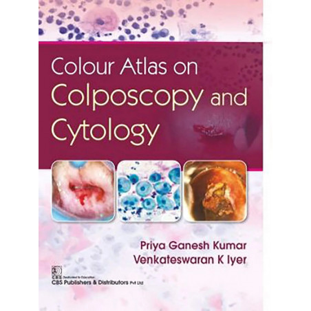 COLOUR ATLAS ON COLPOSCOPY AND CYTOLOGY (HB 2020) book by PRIYA GANESH KUMAR