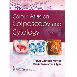 COLOUR ATLAS ON COLPOSCOPY AND CYTOLOGY (HB 2020) book by PRIYA GANESH KUMAR - Back Cover