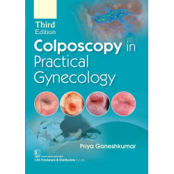 Colposcopy In Practical Gynecology 3Ed (Pb 2025) book by Priya Ganeshkumar
