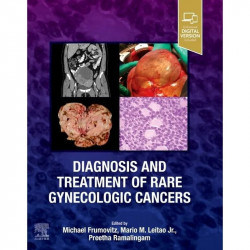 Diagnosis and Treatment of Rare Gynecologic Cancers - 1E book by MD Leitao, Mario, Michael Frumovitz