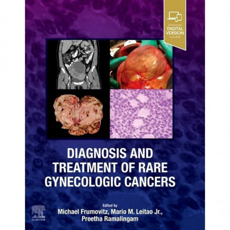 Diagnosis and Treatment of Rare Gynecologic Cancers - 1E book by MD Leitao, Mario, Michael Frumovitz