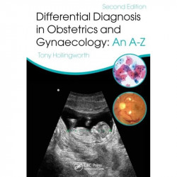 DIFFERENTIAL DIAGNOSIS IN OBSTETRICS AND GYNAECOLOGY AN A TO Z 2ED (HB 2016): An A-Z book by Tony Hollingworth