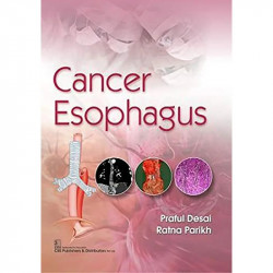 CANCER ESOPHAGUS (PB 2020) book by PRAFUL DESAI - Back Cover
