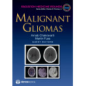 Malignant Gliomas (Radiation Medicine Rounds) book by Arnab Chakravarti, Martin Fuss