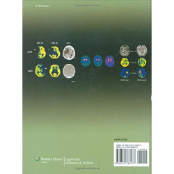 Functional Cerebral Spect & Pet Imaging, 4E (Hb) book by Ronald L.Van Heertum, Ronald S. Tikofsky - Back Cover