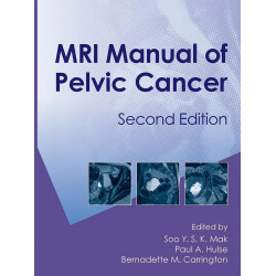 MRI MANUAL OF PELVIC CANCER 2ED (HB 2012) book by Soo Mak, Paul A. Hulse