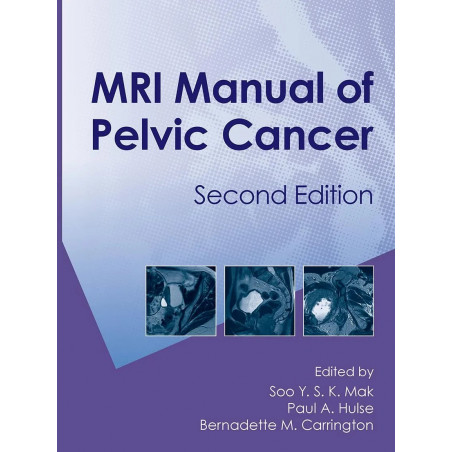 MRI MANUAL OF PELVIC CANCER 2ED (HB 2012) book by Soo Mak, Paul A. Hulse
