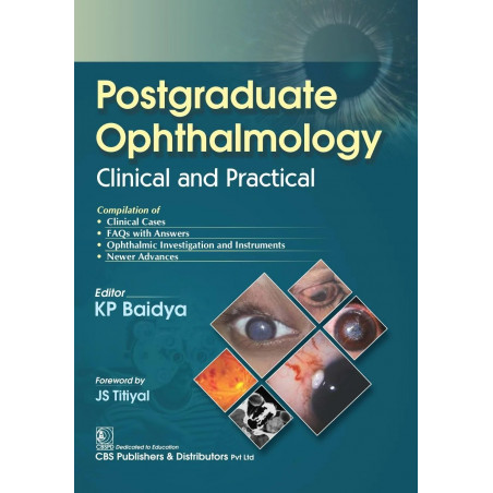 Postgraduate Ophthalmology Clinical And Practical (Pb 2024) book by KP BAIDYA