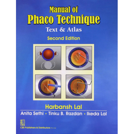 Manual Of Phaco Technique Text And Atlas 2Ed (Hb 2021) book by Harbansh Lal