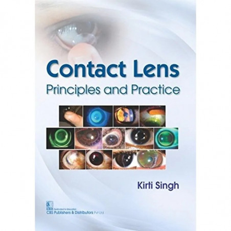 CONTACT LENS PRINCIPLES AND PRACTICE (PB 2017) book by SINGH K